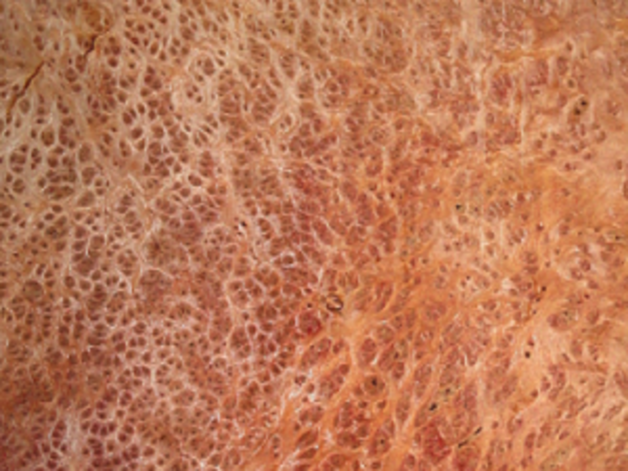 Redwood Burl
